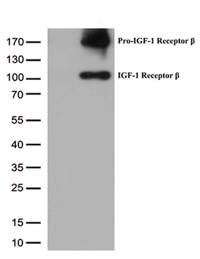 IGF1R Antibody in Western Blot (WB)