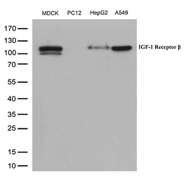 IGF1R Antibody in Western Blot (WB)