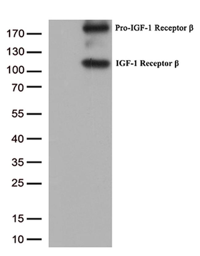 IGF1R Antibody in Western Blot (WB)