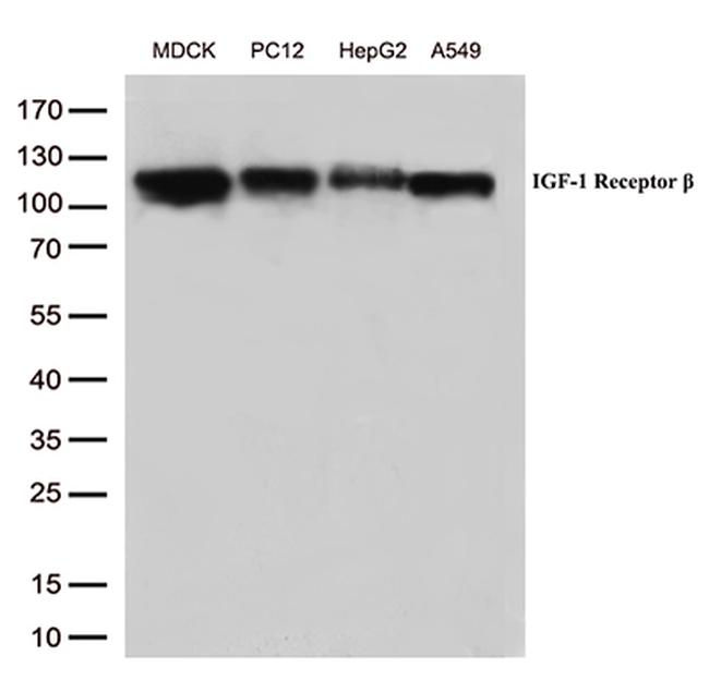 IGF1R Antibody in Western Blot (WB)