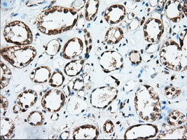 IGF2BP2 Antibody in Immunohistochemistry (Paraffin) (IHC (P))