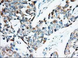 IGF2BP2 Antibody in Immunohistochemistry (Paraffin) (IHC (P))