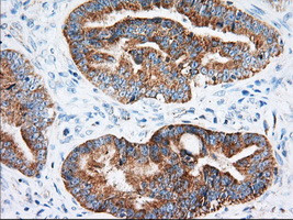 IGF2BP2 Antibody in Immunohistochemistry (Paraffin) (IHC (P))