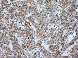 IGF2BP2 Antibody in Immunohistochemistry (Paraffin) (IHC (P))