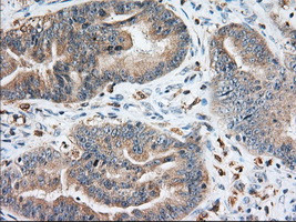 IGF2BP2 Antibody in Immunohistochemistry (Paraffin) (IHC (P))