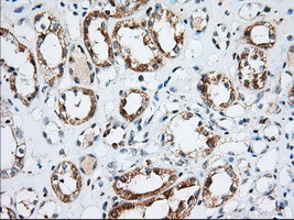 IGF2BP2 Antibody in Immunohistochemistry (Paraffin) (IHC (P))