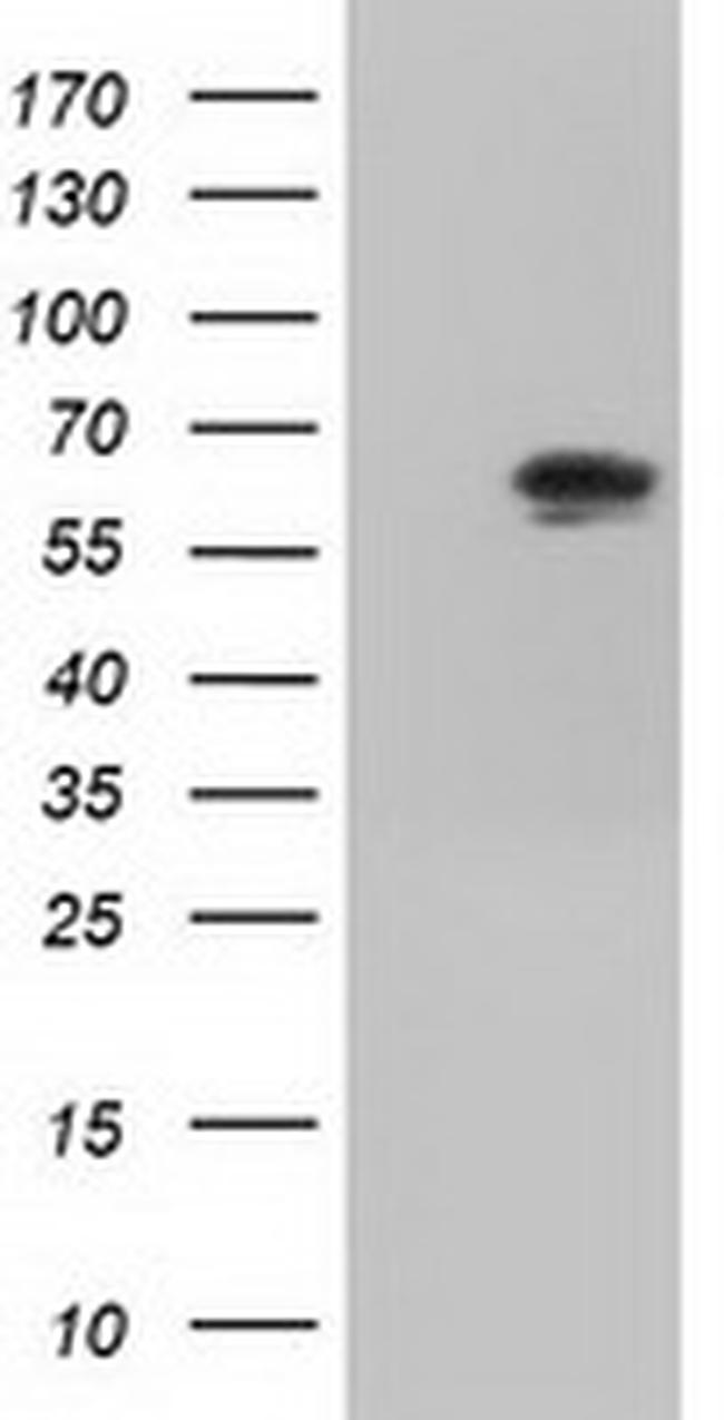 IGF2BP2 Antibody in Western Blot (WB)