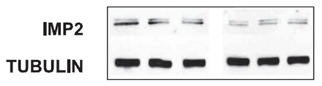 IGF2BP2 Antibody in Western Blot (WB)