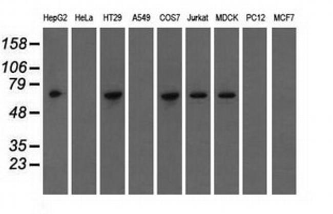 IGF2BP2 Antibody in Western Blot (WB)