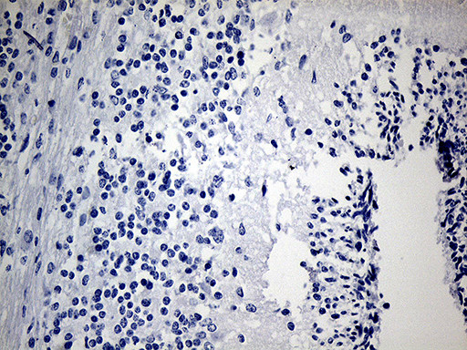 IGF2BP3 Antibody in Immunohistochemistry (Paraffin) (IHC (P))