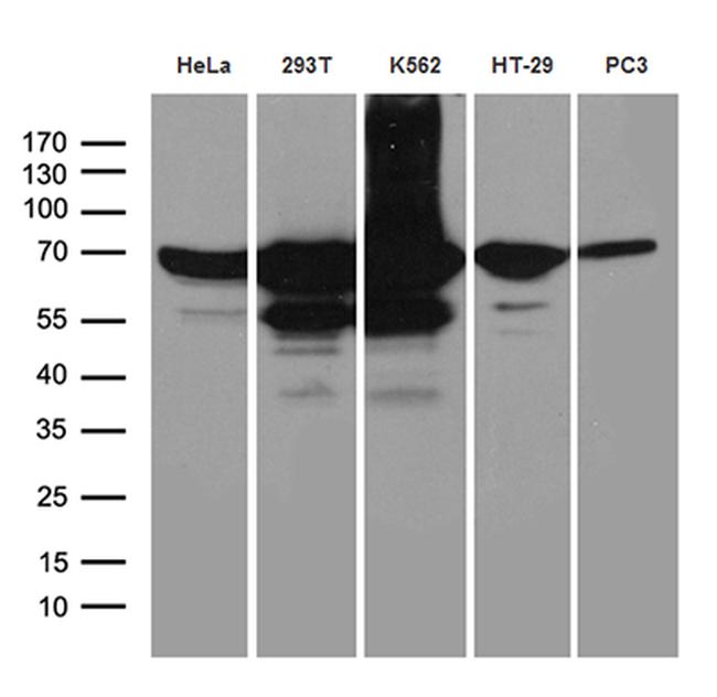 IGF2BP3 Antibody in Western Blot (WB)