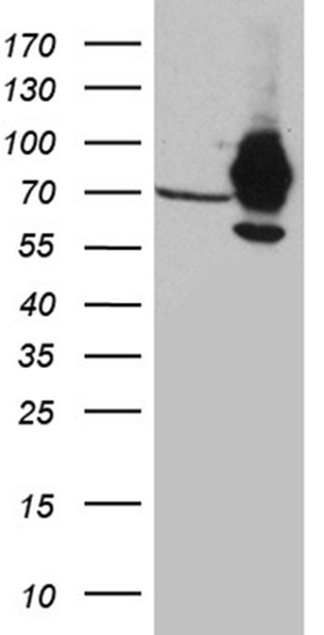 IGF2BP3 Antibody in Western Blot (WB)