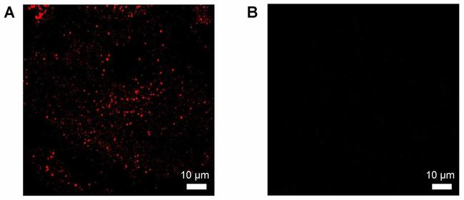 IGF2R Antibody in Immunocytochemistry (ICC/IF)