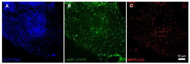 IGF2R Antibody in Immunocytochemistry (ICC/IF)