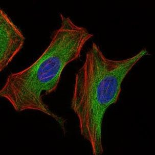 IGF2 Antibody in Immunocytochemistry (ICC/IF)