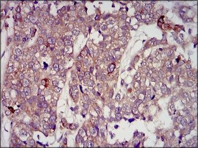 IGF2 Antibody in Immunohistochemistry (Paraffin) (IHC (P))