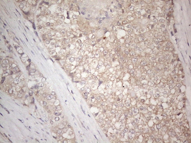 IGFBP1 Antibody in Immunohistochemistry (Paraffin) (IHC (P))