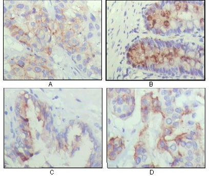 IGFBP2 Antibody in Immunohistochemistry (Paraffin) (IHC (P))