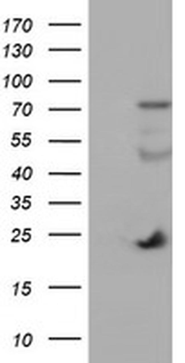 IGJ Antibody in Western Blot (WB)