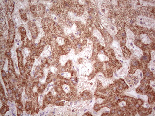 IGSF11 Antibody in Immunohistochemistry (Paraffin) (IHC (P))