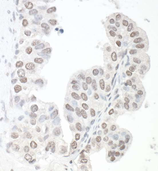 SMC6 Antibody in Immunohistochemistry (IHC)