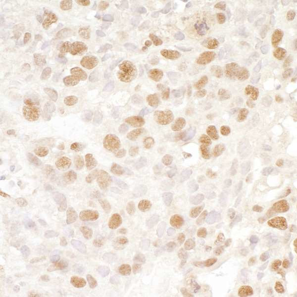 BRD4 Antibody in Immunohistochemistry (Paraffin) (IHC (P))