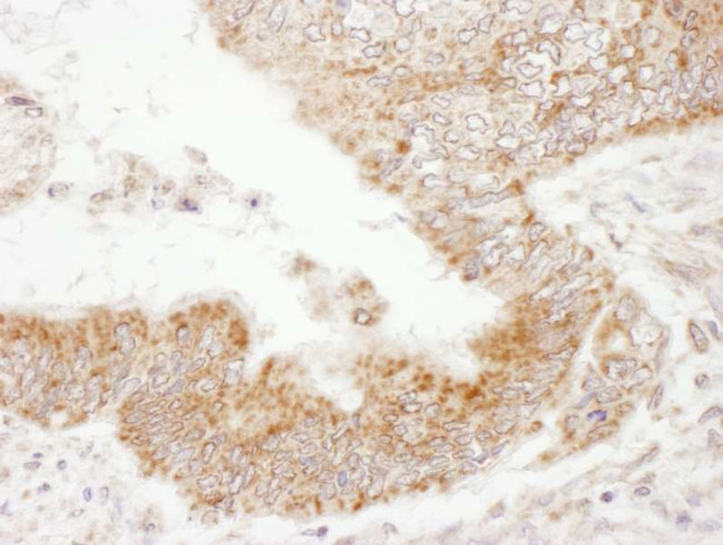 PDZ-GEF1 Antibody in Immunohistochemistry (IHC)