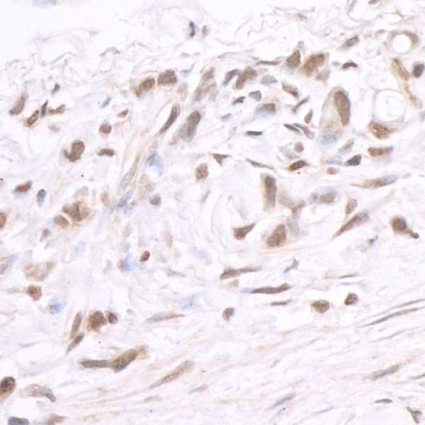 BRD2 Antibody in Immunohistochemistry (Paraffin) (IHC (P))