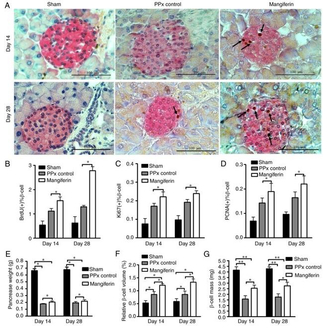 Ki-67 Antibody in Immunohistochemistry (IHC)