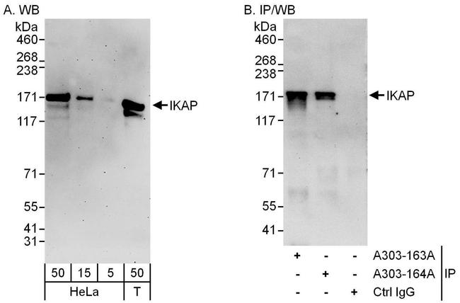 IKAP Antibody in Western Blot (WB)