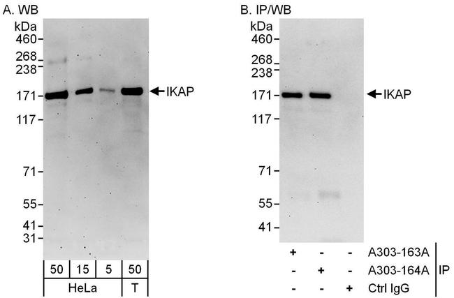 IKAP Antibody in Western Blot (WB)