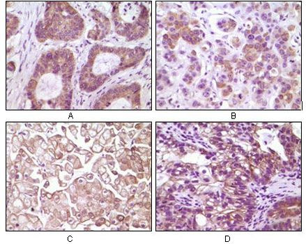 IKK beta Antibody in Immunohistochemistry (Paraffin) (IHC (P))