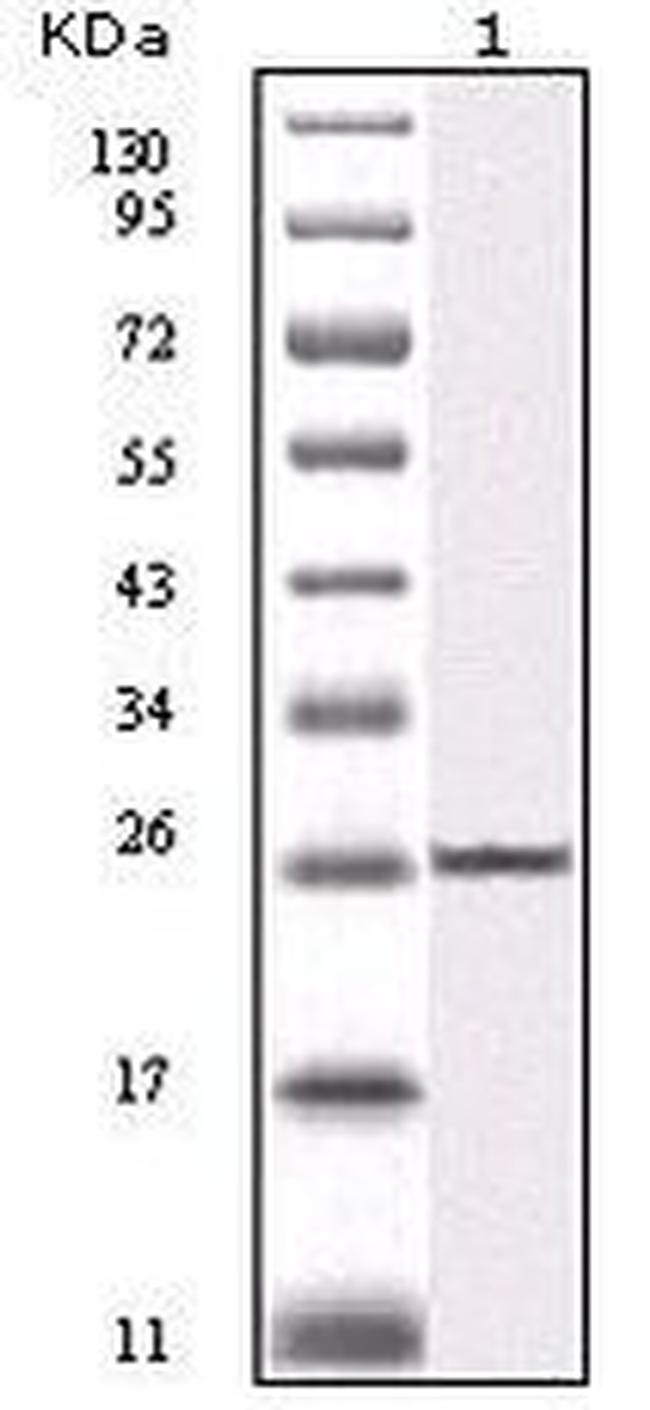 IKK beta Antibody in Western Blot (WB)