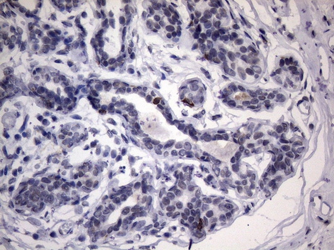 IKBKE Antibody in Immunohistochemistry (Paraffin) (IHC (P))