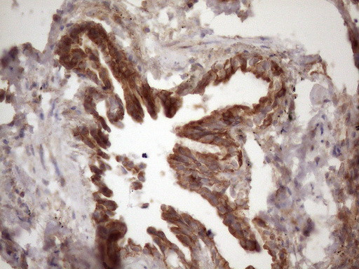 IKBKE Antibody in Immunohistochemistry (Paraffin) (IHC (P))