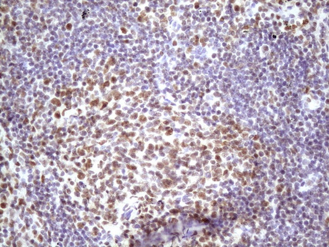 IKBKE Antibody in Immunohistochemistry (Paraffin) (IHC (P))