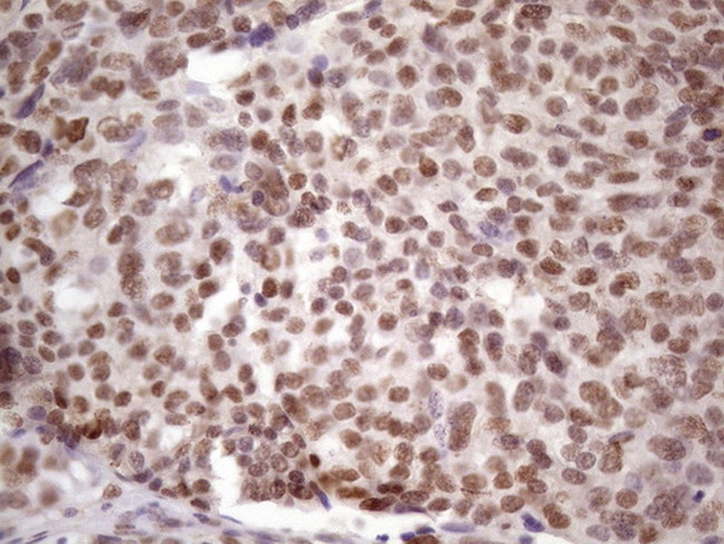 IKBKE Antibody in Immunohistochemistry (Paraffin) (IHC (P))