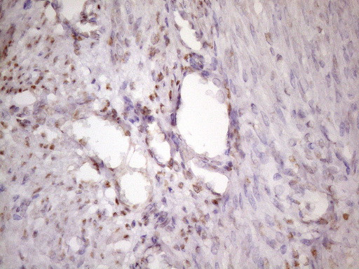 IKBKE Antibody in Immunohistochemistry (Paraffin) (IHC (P))