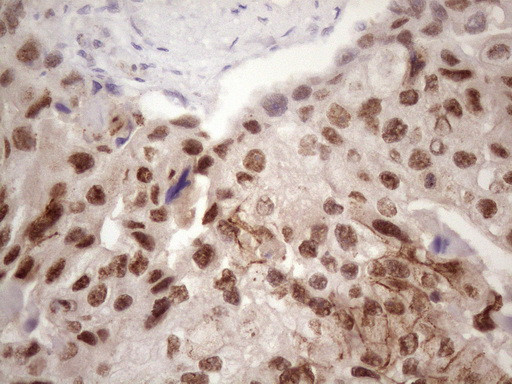 IKBKE Antibody in Immunohistochemistry (Paraffin) (IHC (P))