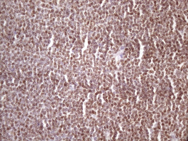 IKBKE Antibody in Immunohistochemistry (Paraffin) (IHC (P))