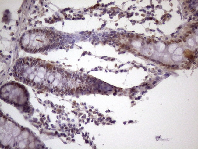 IKBKE Antibody in Immunohistochemistry (Paraffin) (IHC (P))