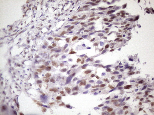 IKBKE Antibody in Immunohistochemistry (Paraffin) (IHC (P))