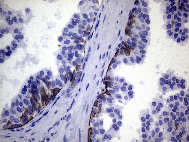 IKBKE Antibody in Immunohistochemistry (Paraffin) (IHC (P))