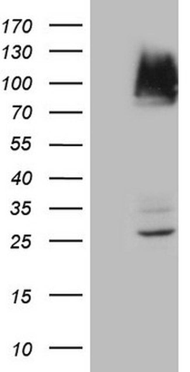 IKBKE Antibody in Western Blot (WB)