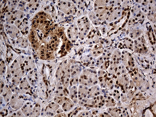 IKBKG Antibody in Immunohistochemistry (Paraffin) (IHC (P))