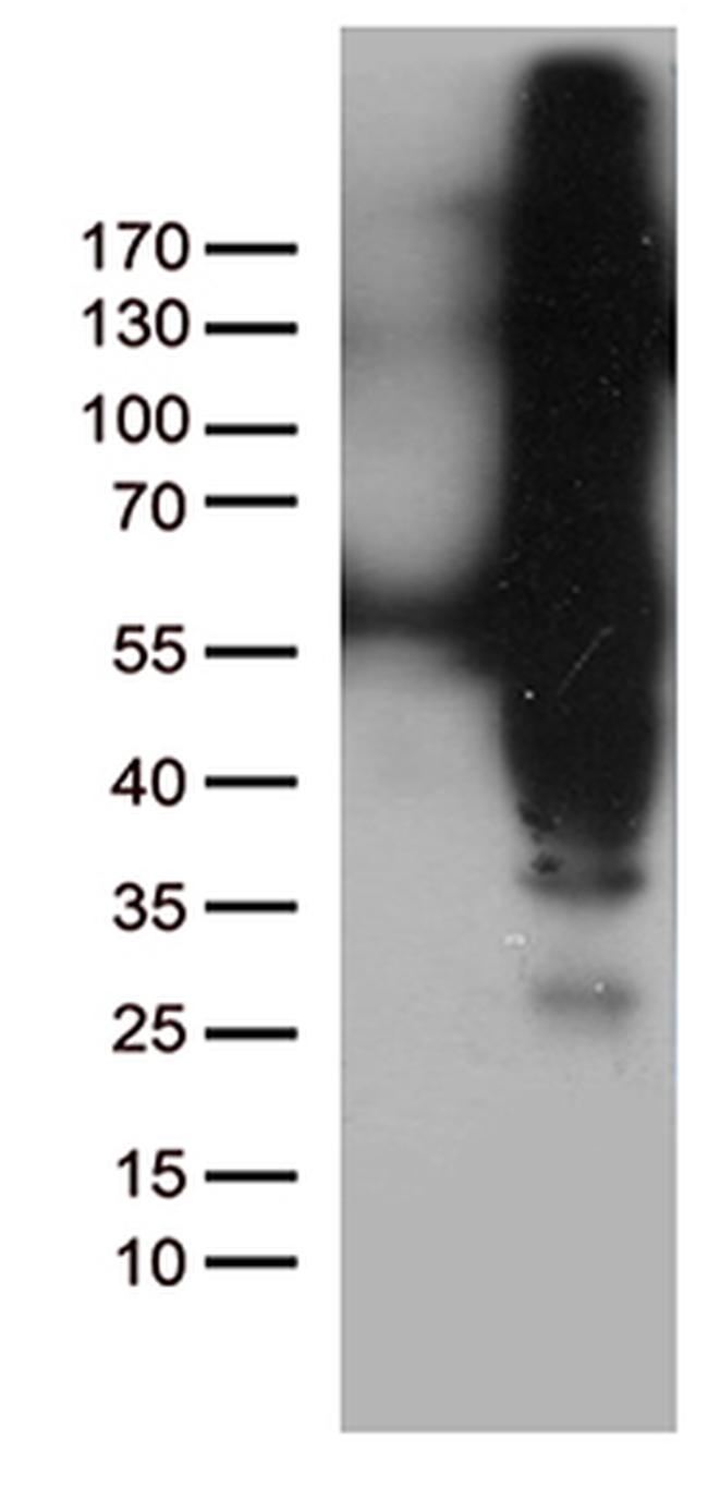 IKBKG Antibody in Western Blot (WB)