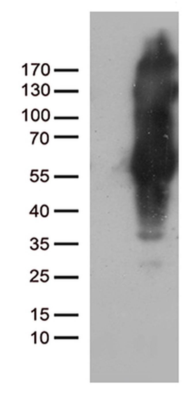 IKBKG Antibody in Western Blot (WB)