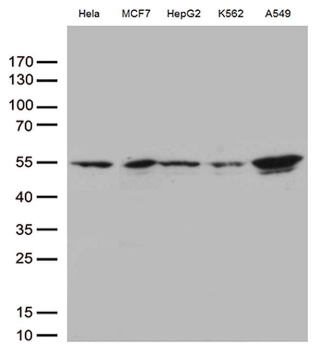 IKBKG Antibody in Western Blot (WB)