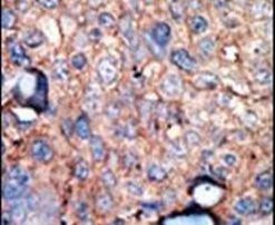 IKK epsilon Antibody in Immunohistochemistry (IHC)