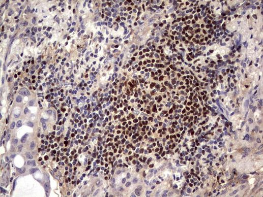 IKZF3 Antibody in Immunohistochemistry (Paraffin) (IHC (P))